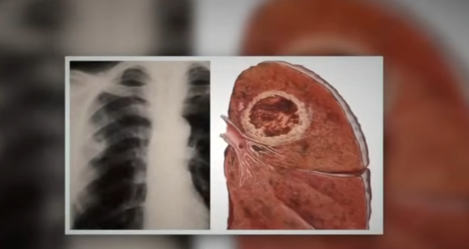 Welche gesundheitlichen Auswirkungen hat die Pfeifenrauchsucht konkret?